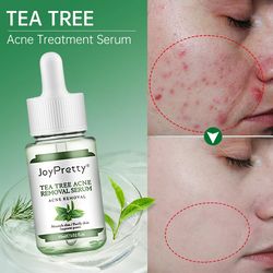 acne treatment face serum tea tree oil essence moisturizing shrink pores acne facial serum korean skin care products