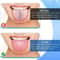 Stainless Steel Tongue Scraper For Fresh Breath U Shaped Metal Tongue Cleaner For Oral Hygiene 2