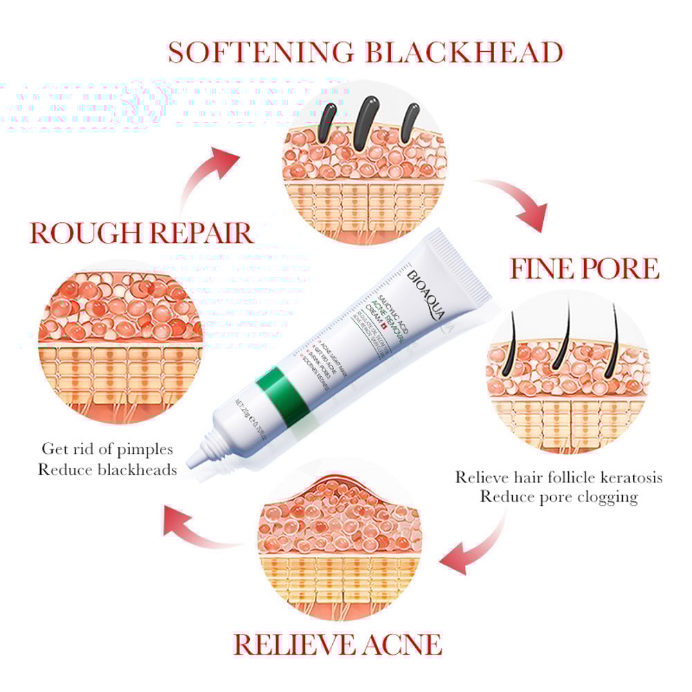 Salicylic Acid Acne Treatment Cream Moisturizing & Firming Face Cream for Acne Marks & Blackheads