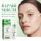 Centella Hydrating Serum Moisturizing Firming And Repairing Face Essence 1