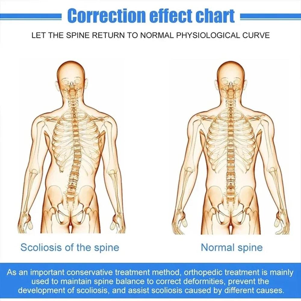 Aluminum Alloy Scoliosis Correcting Brace Adjustable Spinal Straightener Brace for Posture Support Adults and Kids
