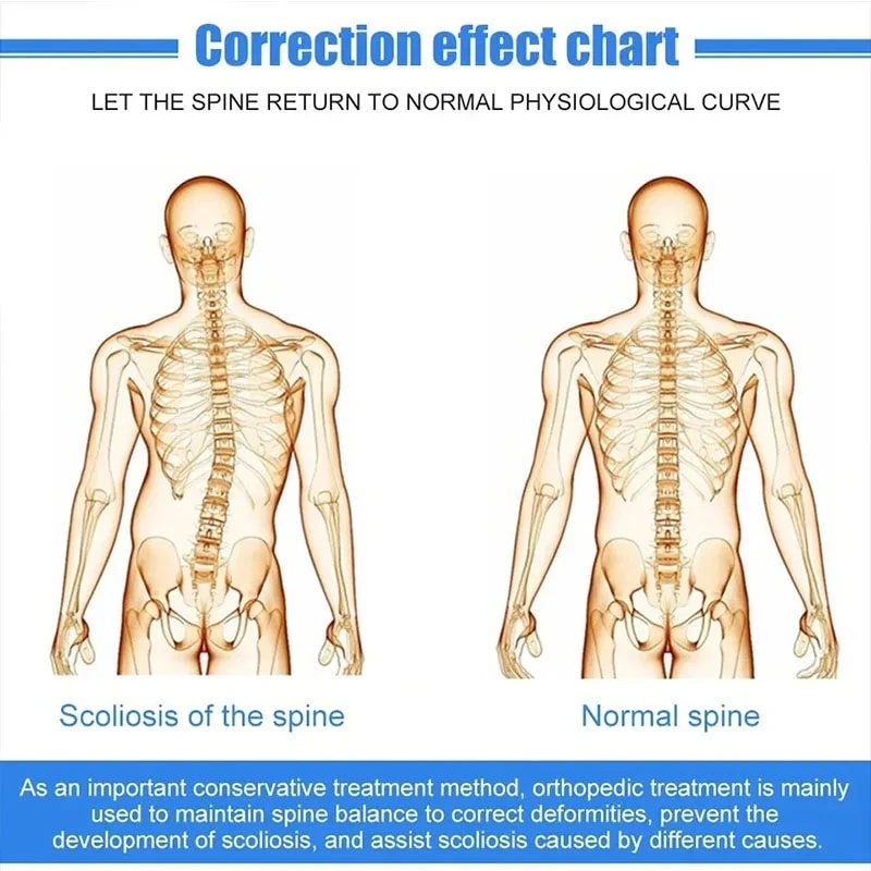 Aluminum Alloy Scoliosis Correcting Brace Adjustable Spinal Straightener Brace for Posture Support Adults and Kids