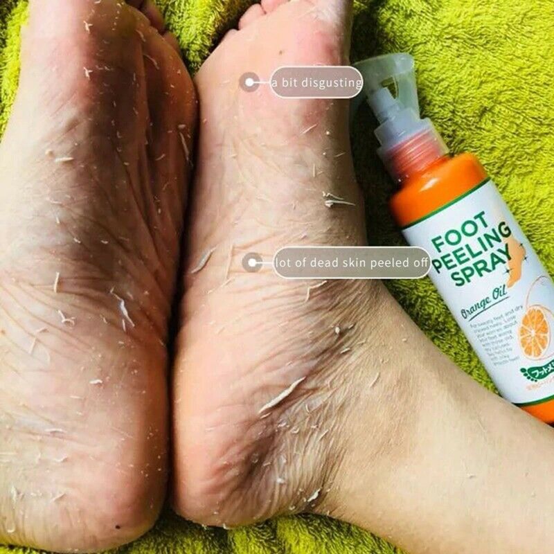 Foot Peeling Mask Callus Remover Exfoliating Foot Treatment For Smooth Soft Feet 1