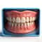 Instant Smile Snap On Dentures Adjustable Fake Teeth Cover For Confident Smiles 0
