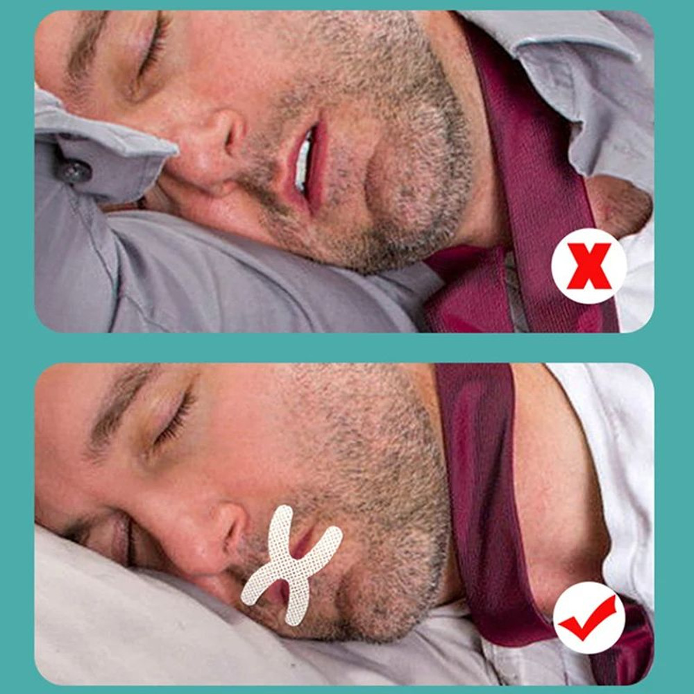 XShape Mouth Tape Stop Snoring Nose Patch  Good Sleeping Aid Mouth Guard Device 3