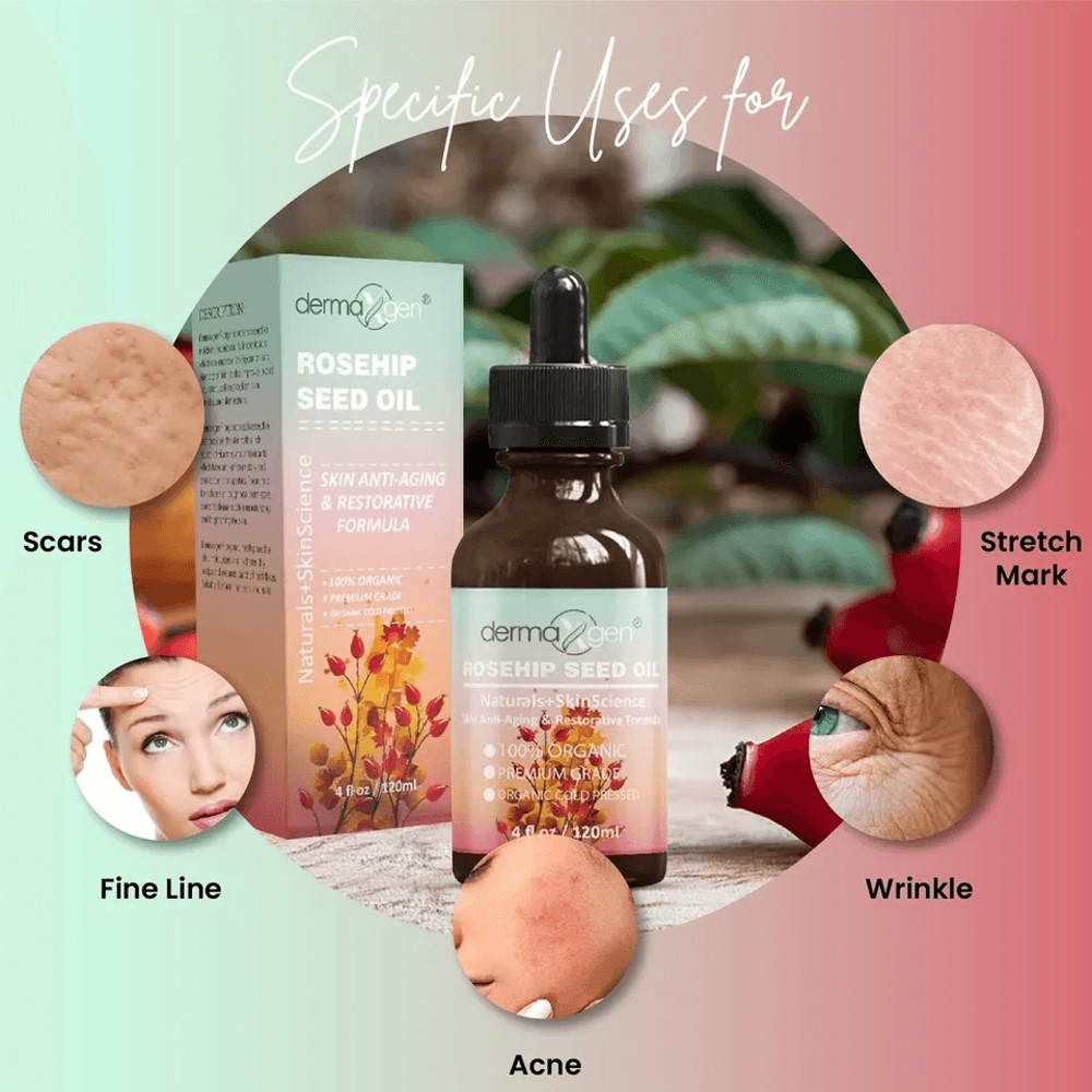 Organic Rosehip Seed Oil Cold Pressed Moisturizer For Acne Dandruff  Skin Hydration 4oz 5