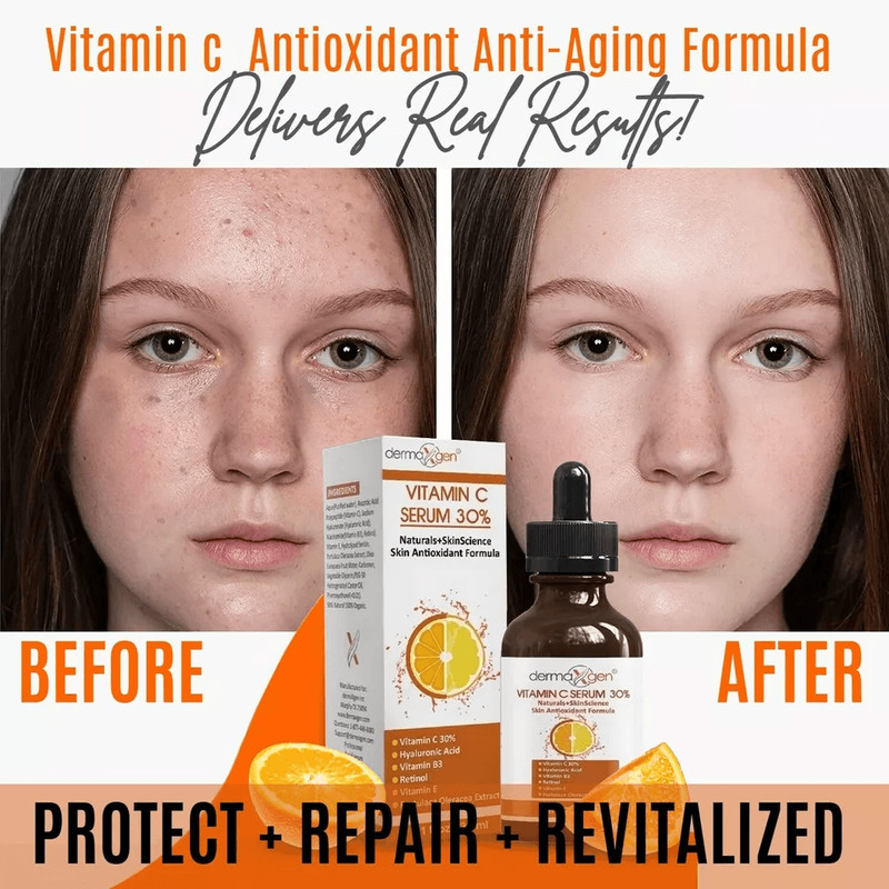Pure Vitamin C Serum With Vitamin B3EHyaluronic Acid AntiAging Brightening Antioxidant Formula 2