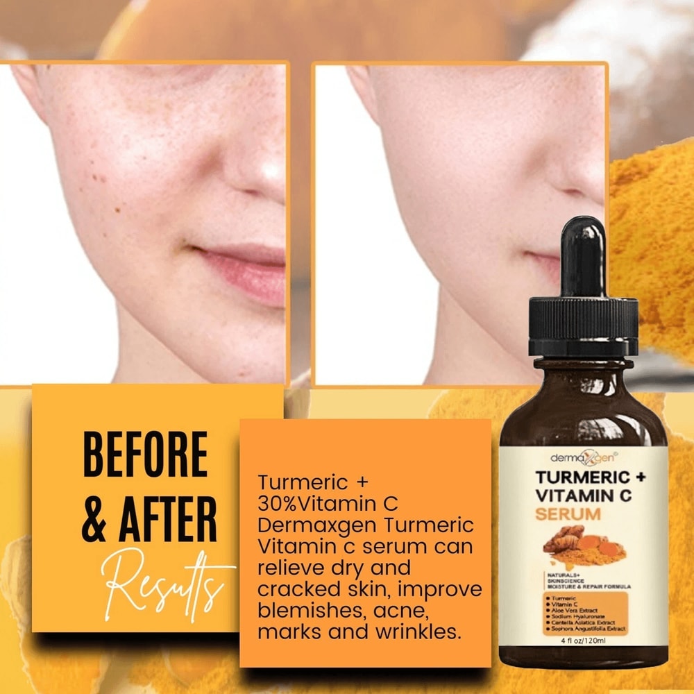 Organic Turmeric Face Serum Dermaxgen Skin Brightening Formula With Pure Vitamin C Hyaluronic Acid 1