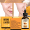 Organic Turmeric Face Serum Dermaxgen Skin Brightening Formula With Pure Vitamin C Hyaluronic Acid 1