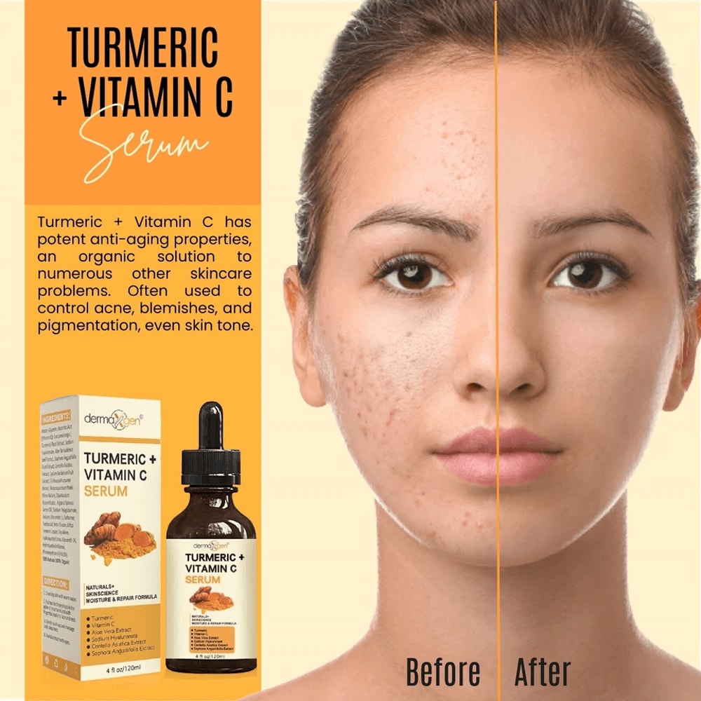 Organic Turmeric Face Serum Dermaxgen Skin Brightening Formula With Pure Vitamin C Hyaluronic Acid 6