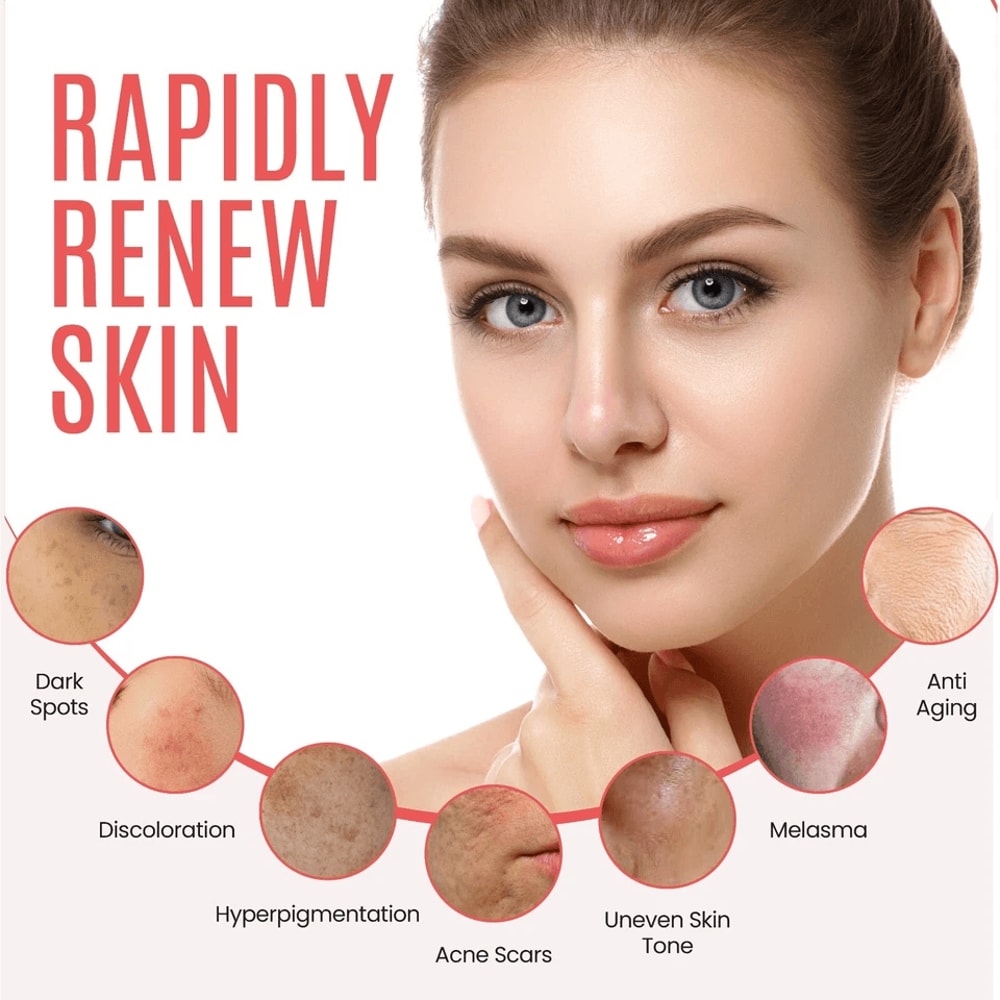 Dark Spot Corrector For Face Body Organic Sunspot Remover For Hyperpigmentation Age Spots Uneven S 3