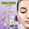 Organic AntiAging Serum Natural Skin Resurfacing For Wrinkles Acne Scars 2