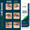 Dermaxgen TIME REVERSE Eye Cream Instant AntiWrinkle Formula To Remove Dark Circles Puffy Eyes Fin 1