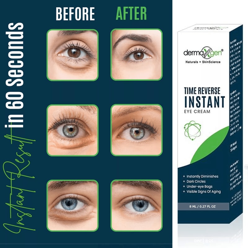Dermaxgen TIME REVERSE Eye Cream Instant AntiWrinkle Formula To Remove Dark Circles Puffy Eyes Fin 1