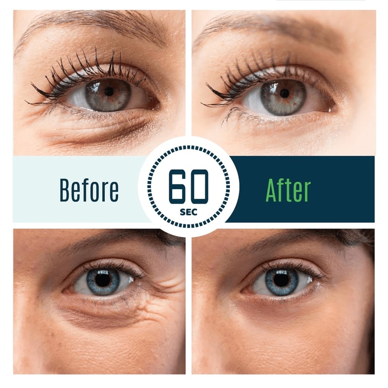 Dermaxgen TIME REVERSE Eye Cream Instant AntiWrinkle Formula To Remove Dark Circles Puffy Eyes Fin 3