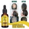 Ginger Hair Care Essence, Liquid Prevent Hair Loss, Nourish Hair Follicles & Strengthen Roots for Healthier Hair