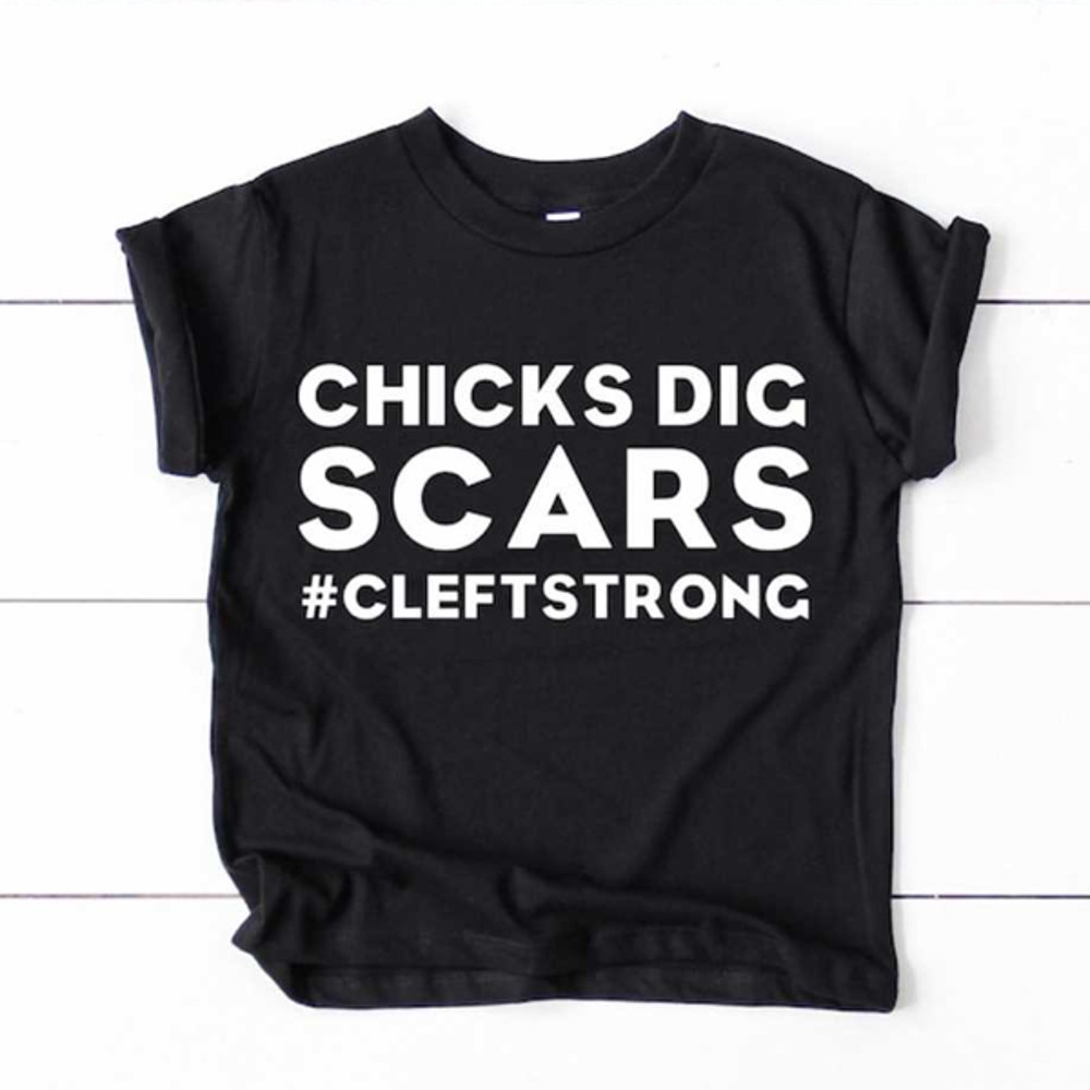 MR1482023135239chicksdigscarscleftpalatecleftstrongimage1jpg