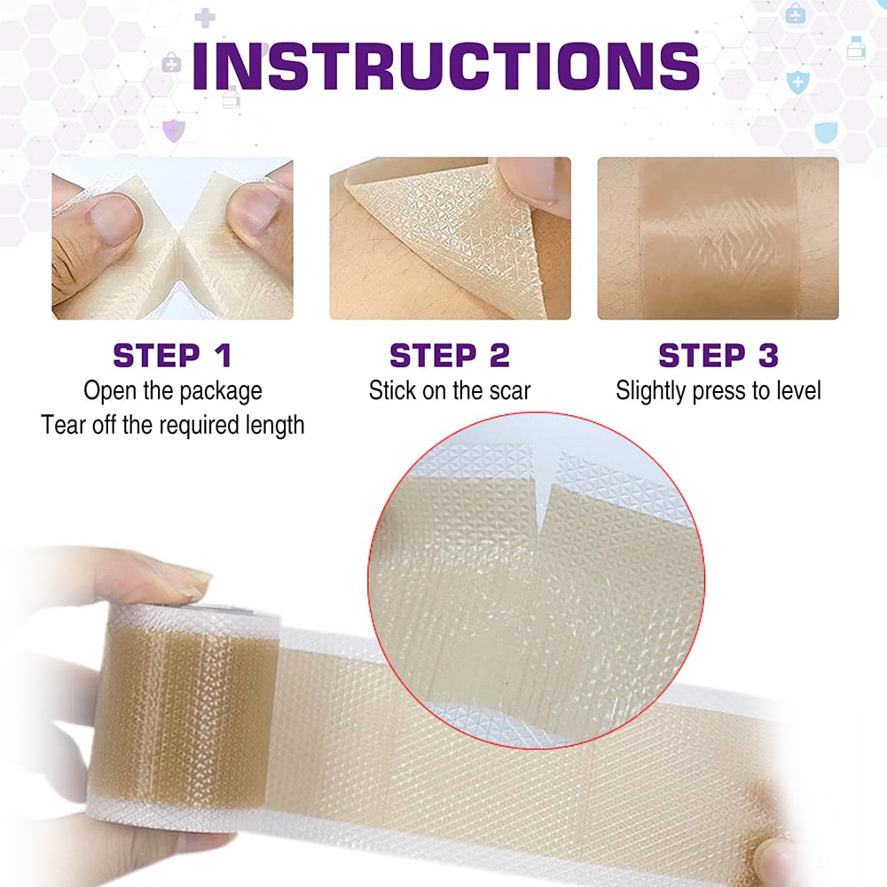 Medical Grade Silicone Scar Sheets For Keloid Surgery Burn Healing 1