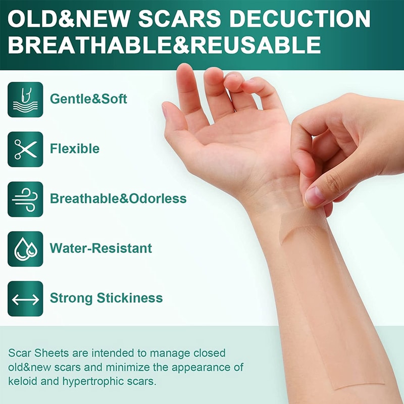 Medical Grade Silicone Scar Sheets For Keloid Surgery Burn Healing 2