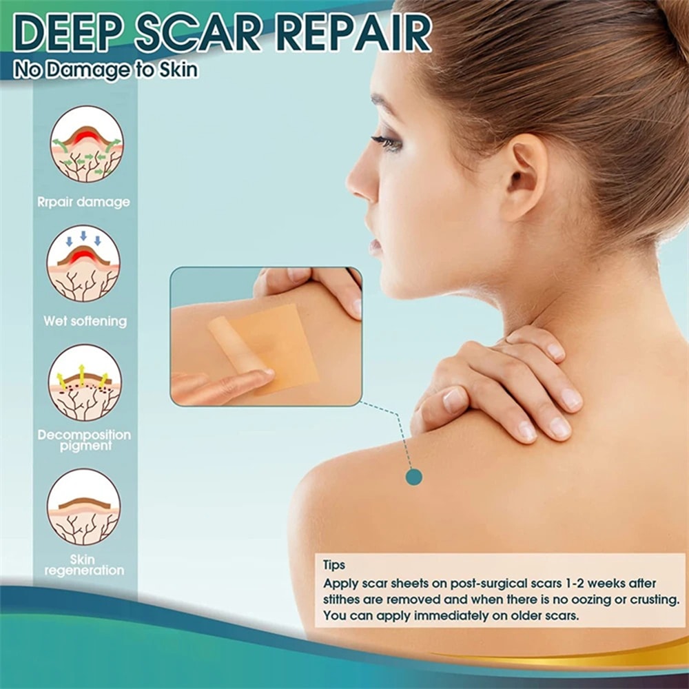 Advanced Silicone Scar Tape Waterproof Breathable Reusable Scar Patch For Skin Protection And Comf 2