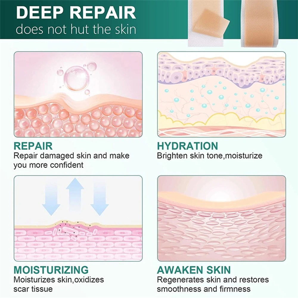 Advanced Silicone Scar Tape Waterproof Breathable Reusable Scar Patch For Skin Protection And Comf 5