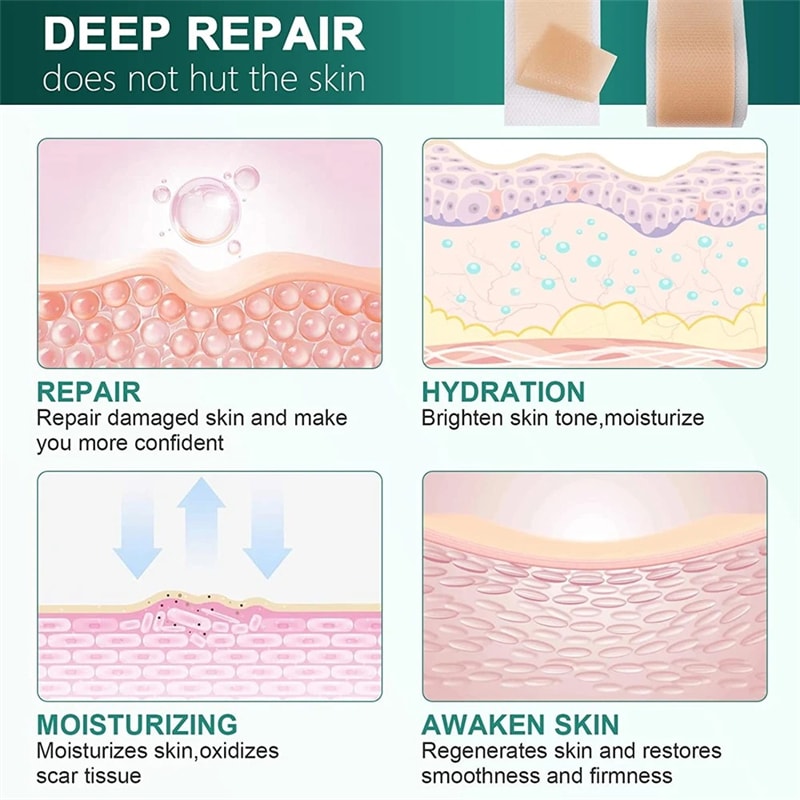 Advanced Silicone Scar Tape Waterproof Breathable Reusable Scar Patch For Skin Protection And Comf 5