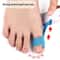 Premium Bunion Relief Tape Precut Bunion Corrector Tape For Toe Alignment Pain Support 3