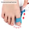 Premium Bunion Relief Tape Precut Bunion Corrector Tape For Toe Alignment Pain Support 3