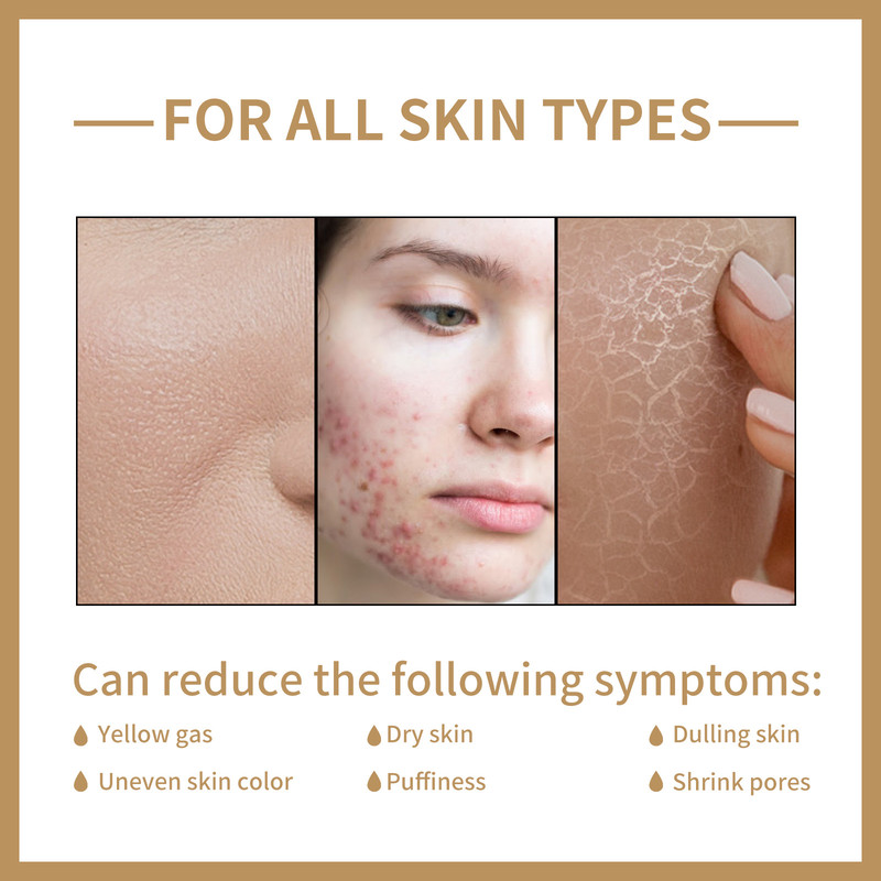 EELHOE Rice Toner for Face – Brightening Serum with Oil Control, Moisturizing Facial Essence for Smooth, Sensitive Skin