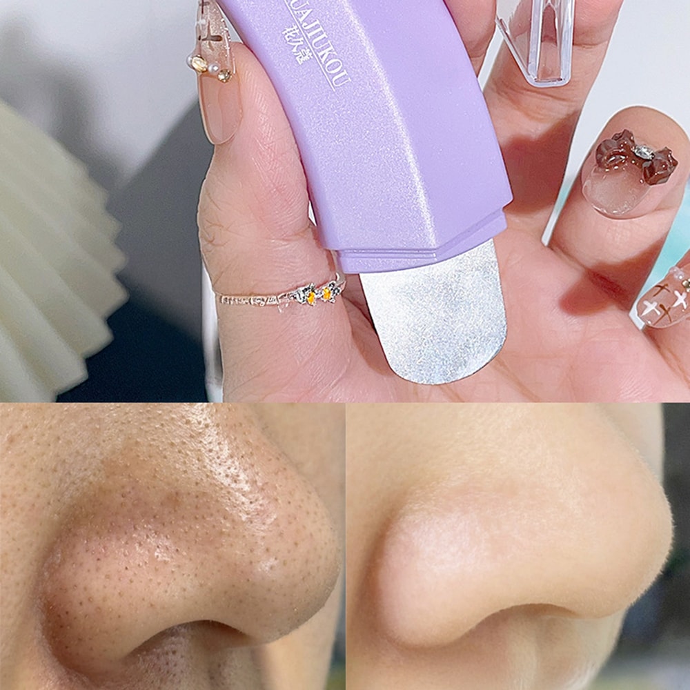 ClearGlow Blackhead Remover Tool For Deep Pore Cleansing Whitehead Extraction 3