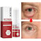 under eye bag removal cream for tired eyes
