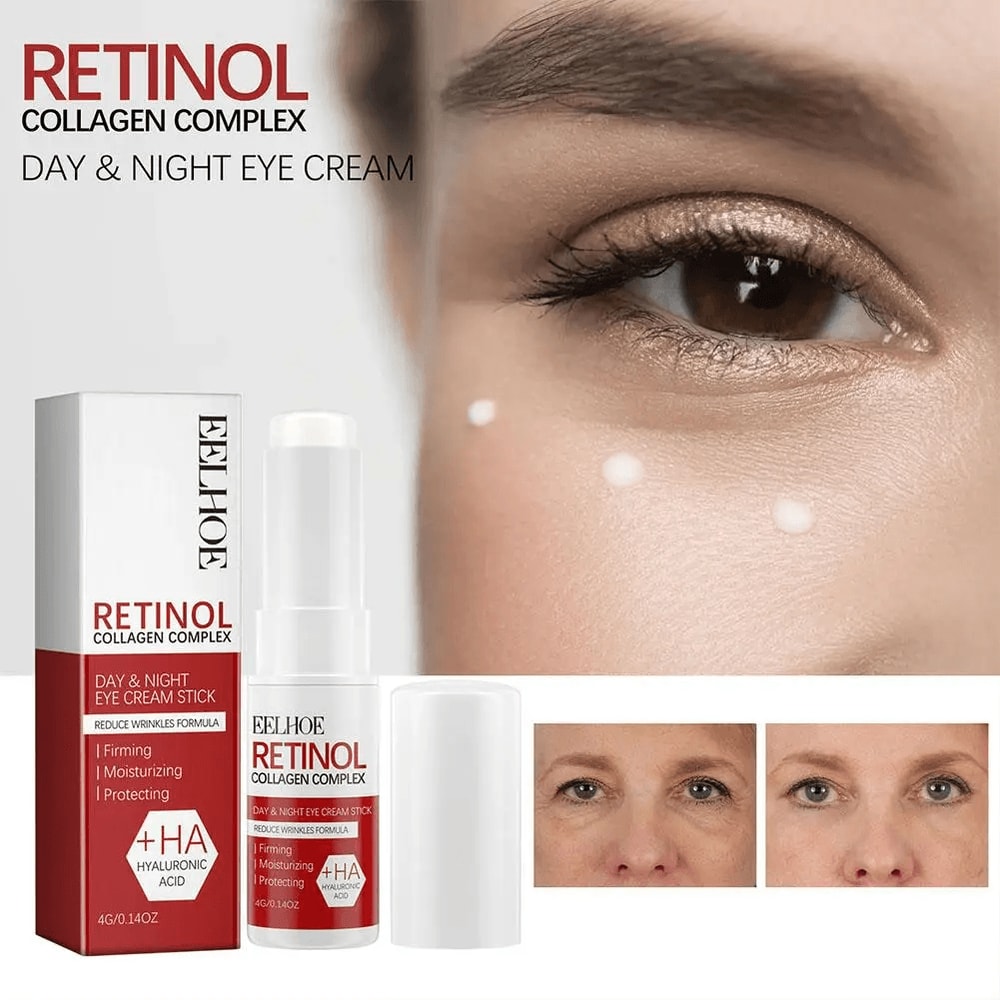 eye cream for puffiness after sleepless nights