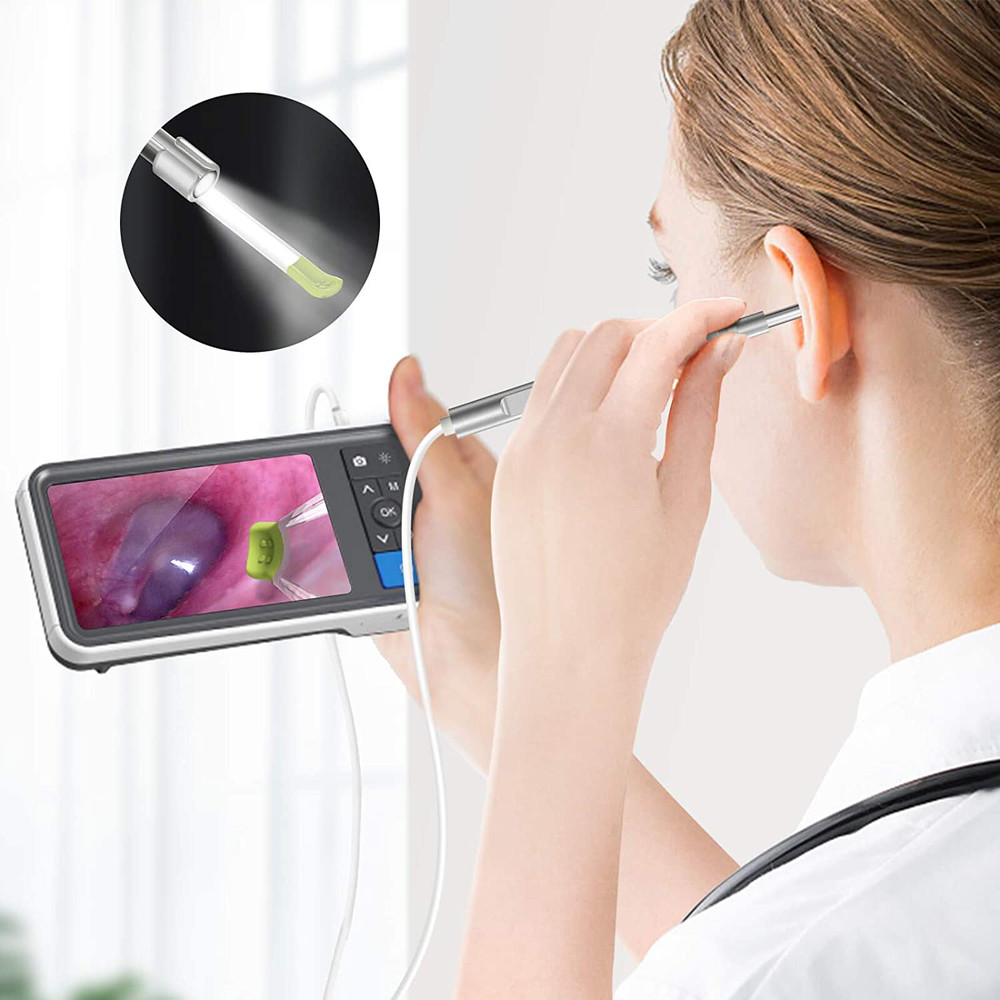 Professional Digital Otoscope with Screen Ear Camera, LED Lights, High GB Storage, Specula, Ear Wax Removal Kit