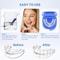 Bruxism Mouth Guard To Stop Snoring AntiSnoring Sleep Apnea Guard 3