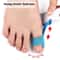 Self Adhesive Bunion Corrector Toe Separator For Hallux Valgus Relief For Men And Women 3
