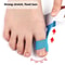 Self Adhesive Bunion Corrector Toe Separator For Hallux Valgus Relief For Men And Women 3