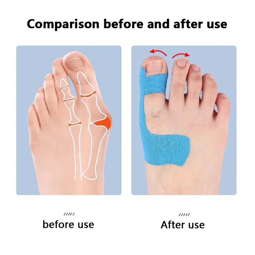 Self Adhesive Bunion Corrector Toe Separator For Hallux Valgus Relief For Men And Women 4