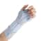 Adjustable Wrist Fracture Splint Brace For Pain Relief And Recovery 0