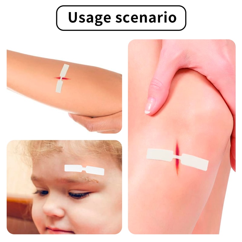 Small Waterproof Butterfly Adhesive Bandages For Emergency Wound Care First Aid Kit MustHave 1