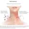DolphinLift Vibrating Neck Face Massager For Wrinkle Care And Skin Rejuvenation 3