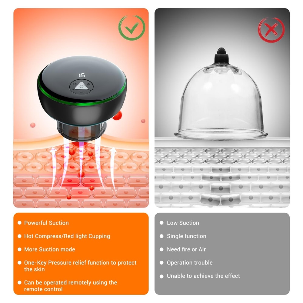 Smart Heated Electric Cupping Massager With Remote Control Deep Tissue Heat Therapy 5