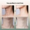 RadianceLift EMS Neck Face Massager With LED Light Therapy And Heat Care 10