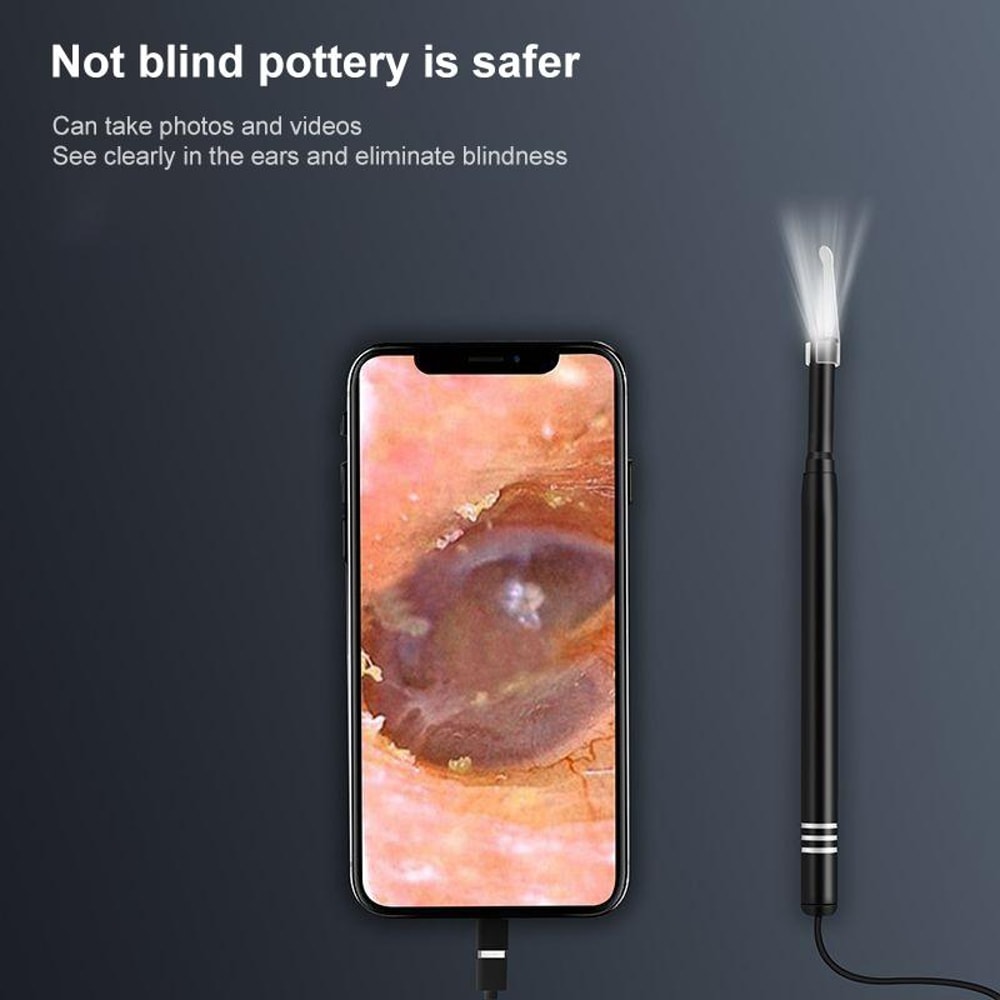 Smart Visual Ear Wax Removal Camera with HD Otoscope Lens & LED Ear Cleaner