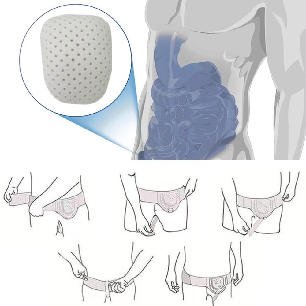 Adjustable Inguinal Hernia Belt For Men Women With Targeted Compression Support 7