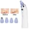 RadianceLift Blackhead Remover Vacuum Diamond Microdermabrasion Pore Cleaner 6