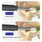 Smart HD Ear Wax Removal Camera With App Control Wireless Visual Ear Cleaner 4
