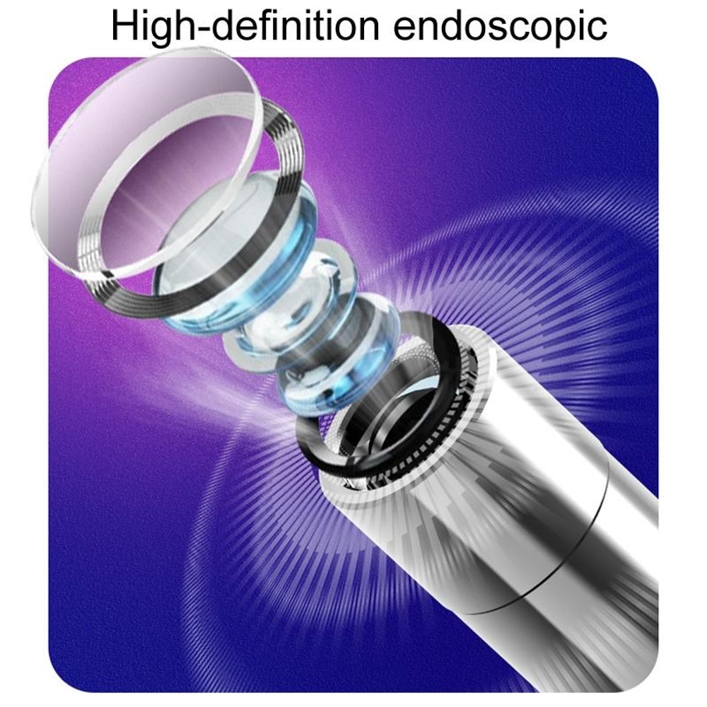 Smart HD Ear Wax Removal Camera With App Control Wireless Visual Ear Cleaner 5