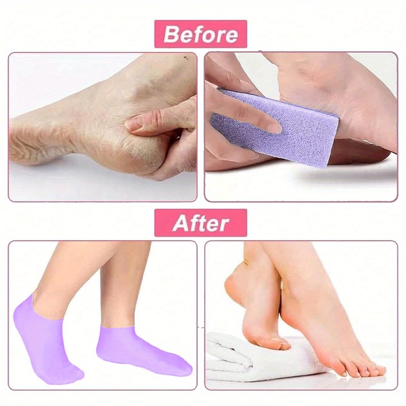 Silicone Socks For Dry Cracked Feet Moisturizing Foot Socks Women Foot Socks For Moisturizing Featu 3
