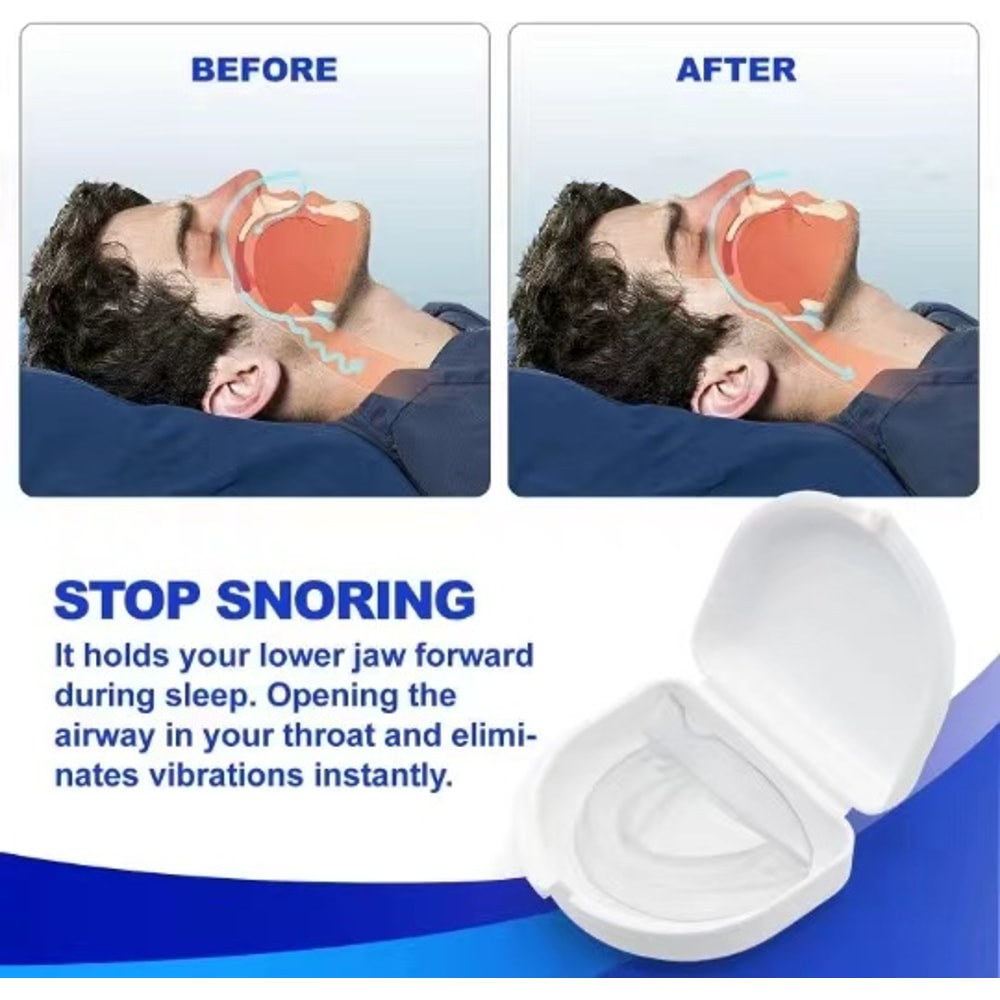 Anti Snore Mouth Guard Custom Molding Anti Snoring Stop Grinding Mouthpiece Adjustable With Storage 5