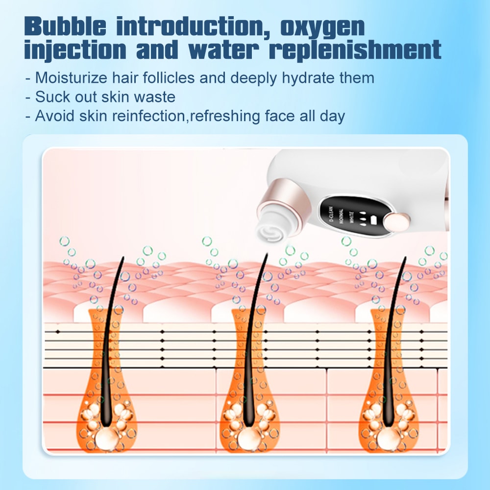 Electric Pimple Acne Blackhead Remover USB Rechargeable Face Cleaner Pore Vacuum Black Dot Removal 5